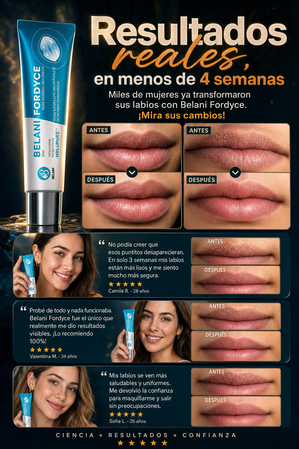Belani Fordyce Lip Cream