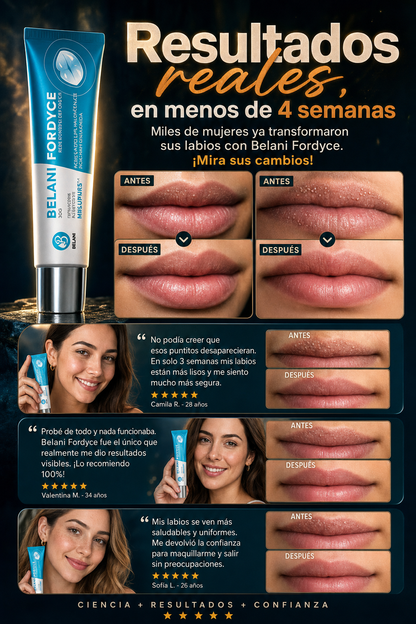 Belani Fordyce Lip Cream